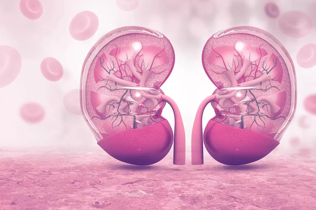 Chronic kidney disease image
