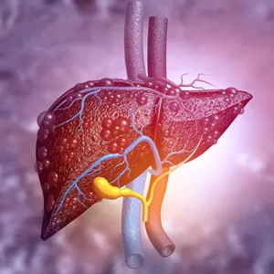 Fatty liver