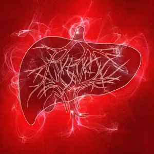 Liver fibrosis